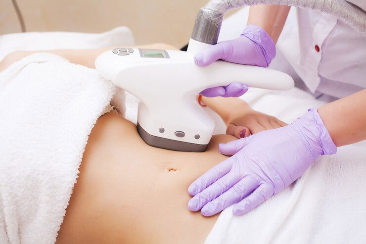 النحت (Body Sculpting)