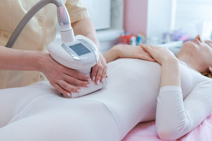 الكونتور (Body Contouring)